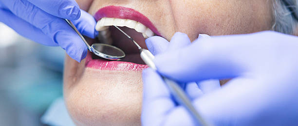 Best Emergency Wisdom Teeth Removal in Buckhall, VA